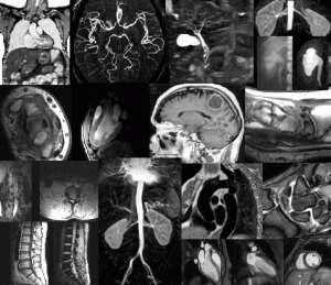 O exame requer a analise dos mínimos detalhes, pois são eles que decide a biopsia final. 