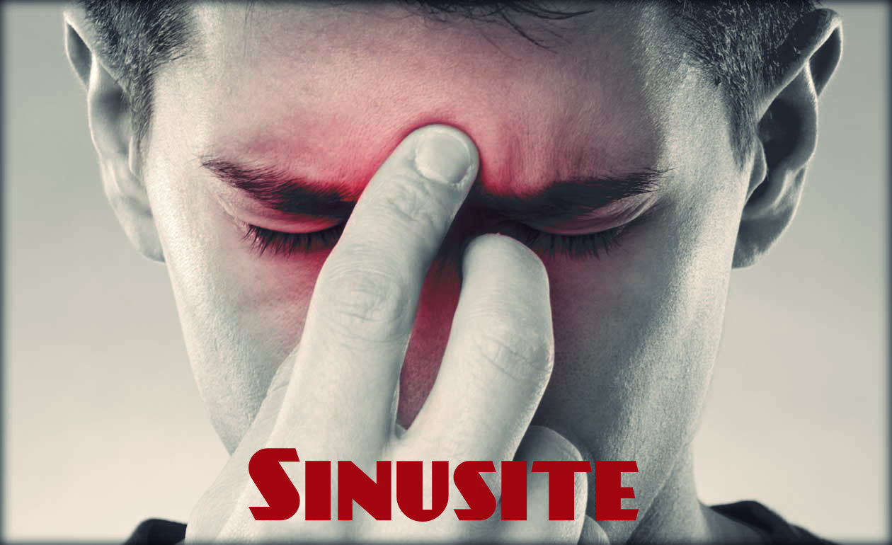 Sinusite: causas, sintomas, tratamento e prevenção