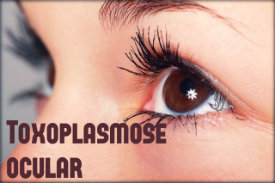 Toxoplasmose ocular: causas, sintomas, tratamento e prevenção.