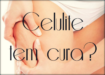 Celulite tem cura?