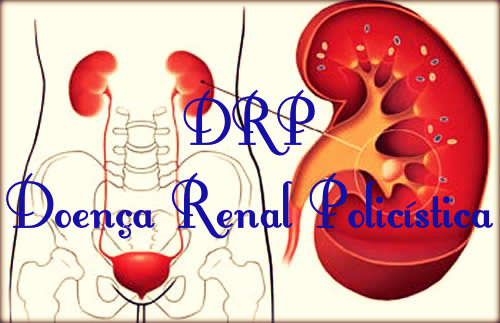 DRP: causas, sintomas, tratamento e complicações.