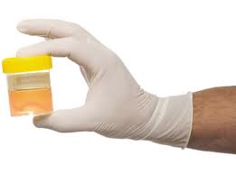 Diagnostico sangue na urina