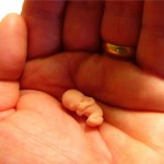 Caso tenha sofrido um aborto, procure auxílio médico e inicie seu tratamento.