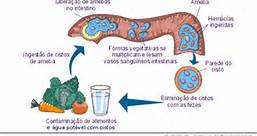 amebíase11
