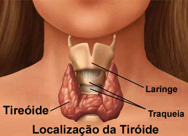 E super importante que se trate essa doença, pois o quadro dela pode se desenvolver, fazendo assim com que o seu portador, pague com as consequências. 