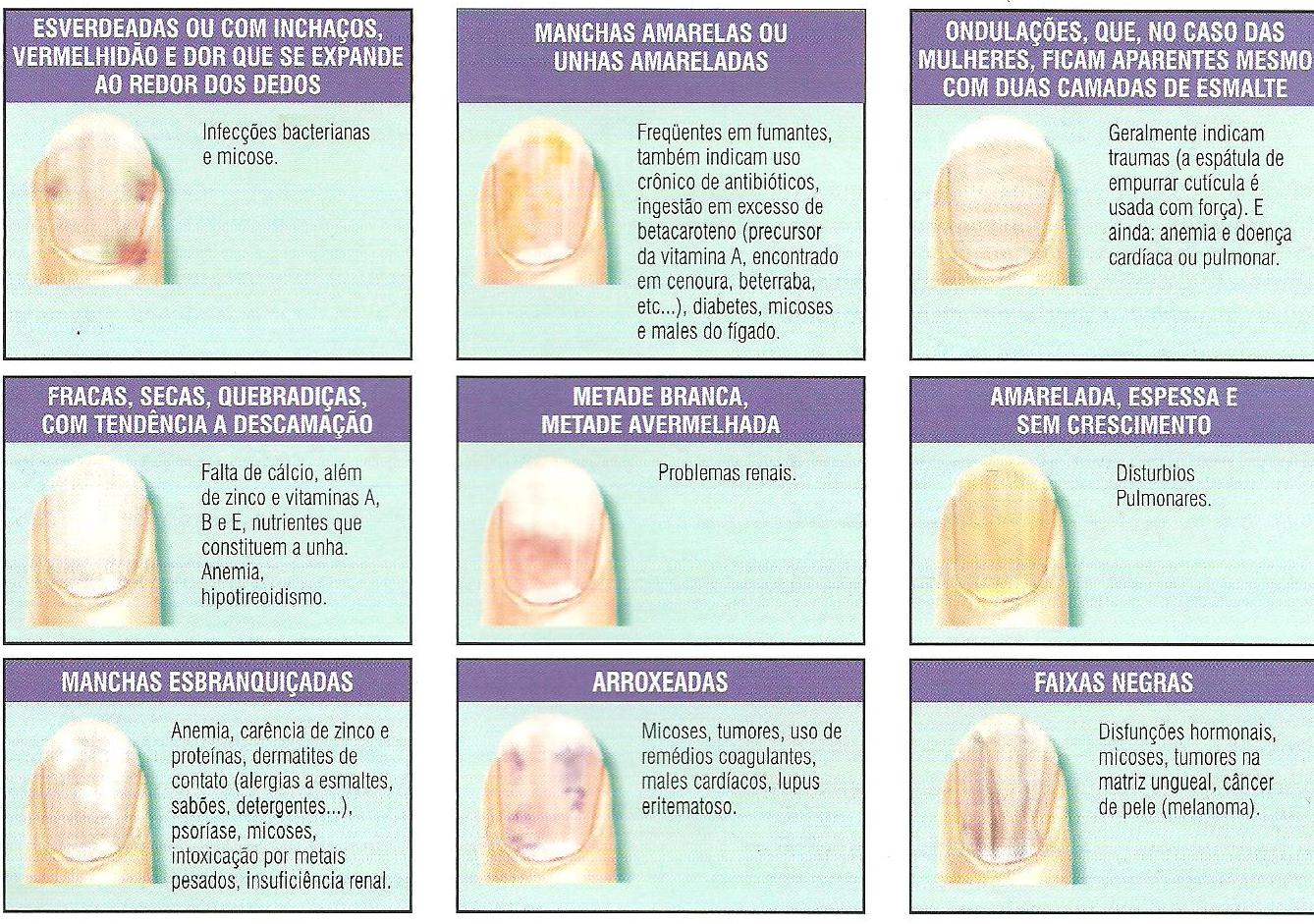 Veja na imagem o porque as suas unhas podem estar fracas. 